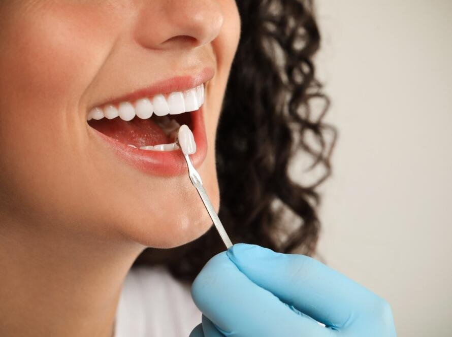 Teeth Whitening in New Delhi