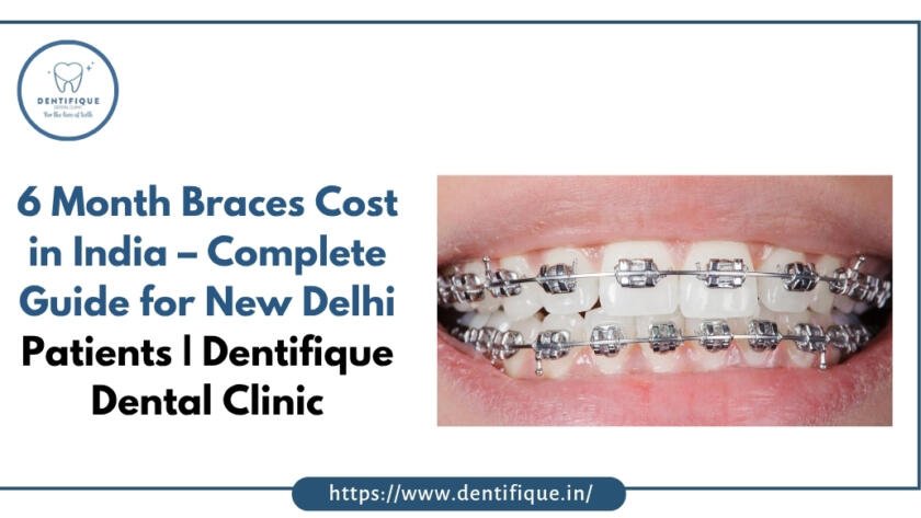 6 Month Braces Cost in India