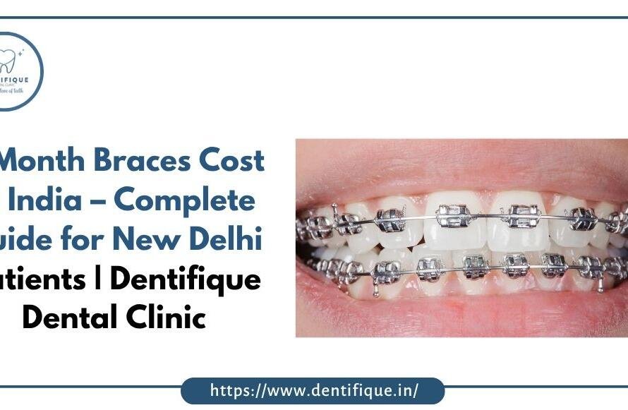 6 Month Braces Cost in India – Complete Guide for New Delhi Patients Dentifique Dental Clinic