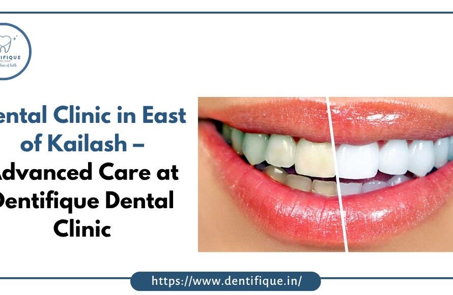 Dental Clinic in East of Kailash – Advanced Care at Dentifique Dental Clinic