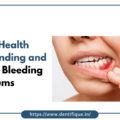 Gum Health: Understanding and Treating Bleeding Gums in East of kailash, New Delhi