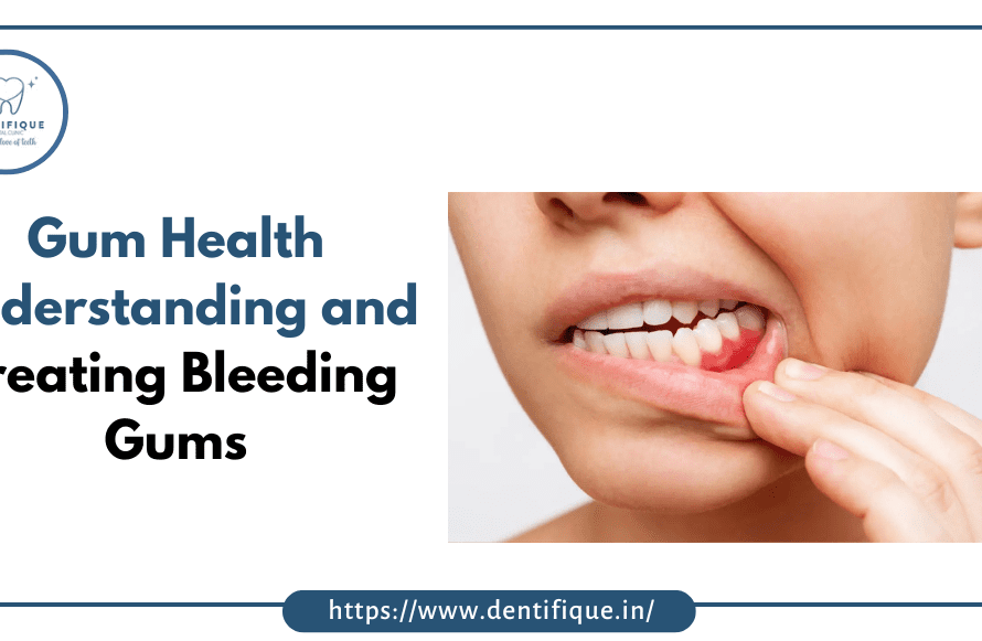 Gums bleeding