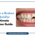 How to Fix a Broken Tooth Quickly: The Ultimate Restoration Guide