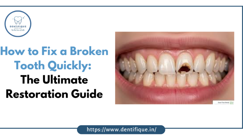 cracked tooth syndrome